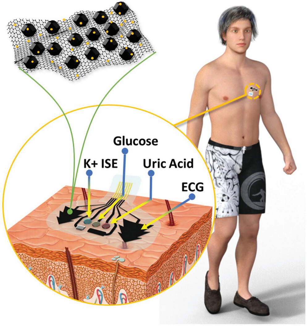 A MOFs-Derived Hydroxyl-Functionalized Hybrid Nanoporous Carbon Incorporated Laser-Scribed Graphene-Based Multimodal Skin Patch for Perspiration Analysis and Electrocardiogram Monitoring